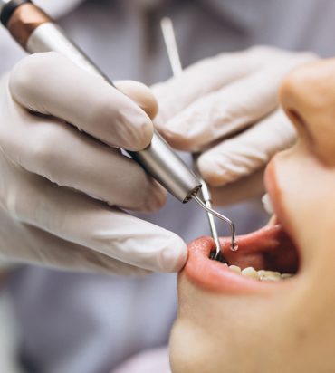 Importanța Controlului Hemostatic în Stomatologie: Tehnici și Soluții pentru un Câmp Operator Optim