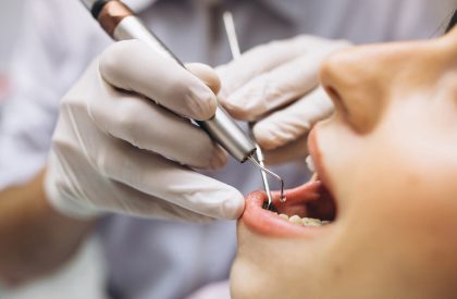 Importanța Controlului Hemostatic în Stomatologie: Tehnici și Soluții pentru un Câmp Operator Optim