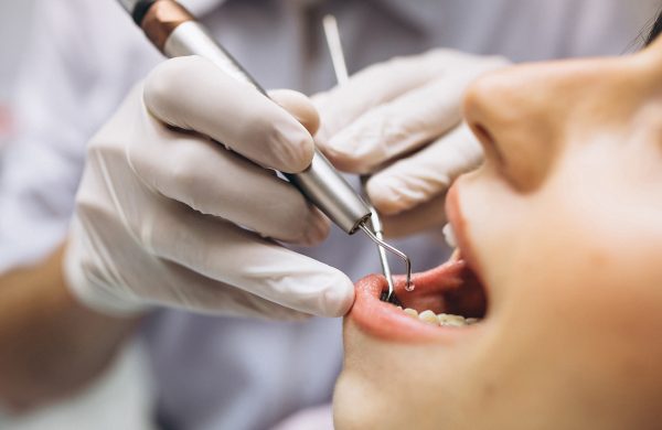 Importanța Controlului Hemostatic în Stomatologie: Tehnici și Soluții pentru un Câmp Operator Optim